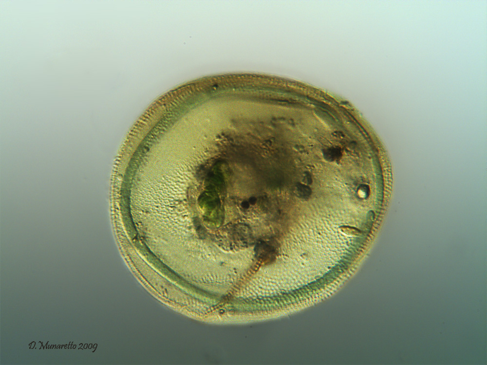 Arcella...ingorda di Oscillatoria